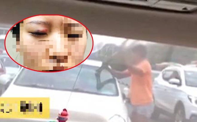 Xin tiền không được, gã đàn ông cầm nạng phang tới tấp vào cửa kính ôtô, hành động sau đó còn đáng sợ hơn