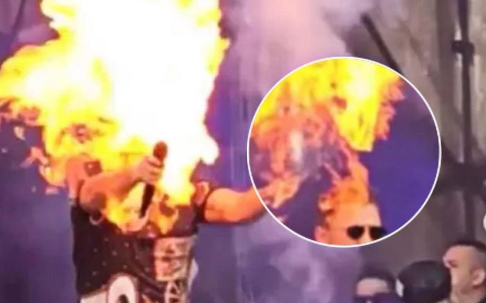 Nam ca sĩ bị quả cầu lửa phun vào đầu, thiêu rụi tóc ngay trên sân khấu
