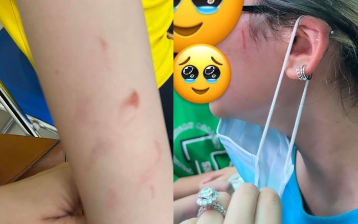 Vụ phụ huynh trường quốc tế tố con bị bạn đánh dã man: Sẽ chấm dứt việc học của con tại ngôi trường này