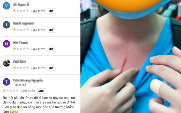 Đại học Quốc tế ở TP.HCM bị 'vạ lây' phải nhận 'bão' 1 sao sau vụ phụ huynh tố con bị bạn học hành hung