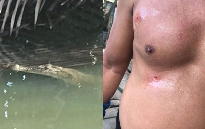 Bị cá sấu dùng hàm kẹp chặt, người đàn ông thoát chết nhờ một hành động nhanh trí