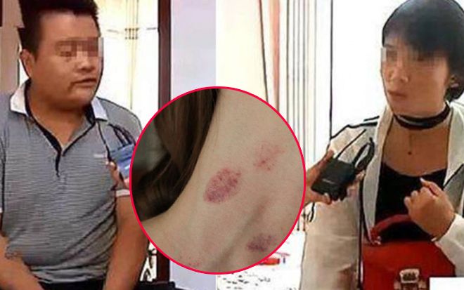 Thấy trên người vợ có dấu răng và vết roi đánh sau khi đi du lịch với bạn, chồng có quyết định bất ngờ