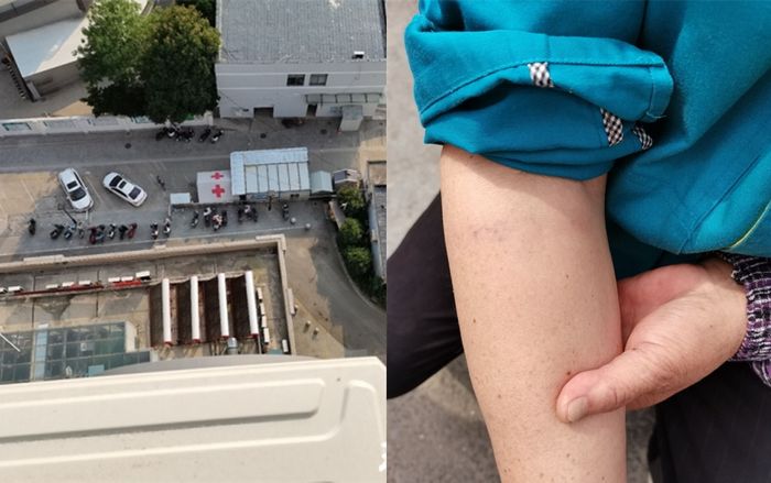 Đang dọn dẹp ngoài chung cư, nữ lao công bị con dao từ 'trên trời' rơi trúng