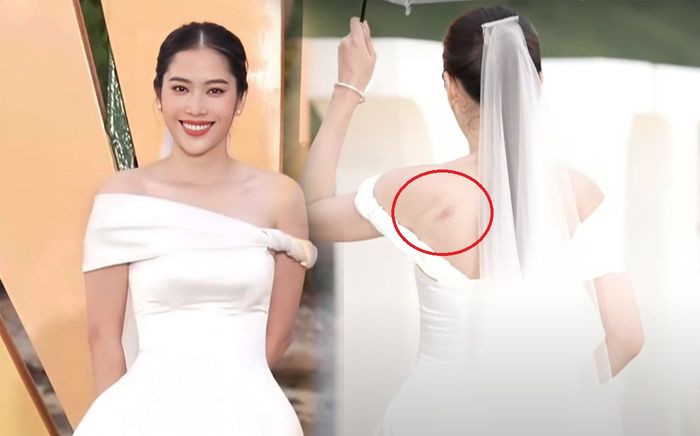 Nam Em catwalk tràn đầy năng lượng nhưng lưng có nhiều vết bầm, thực hư là gì?