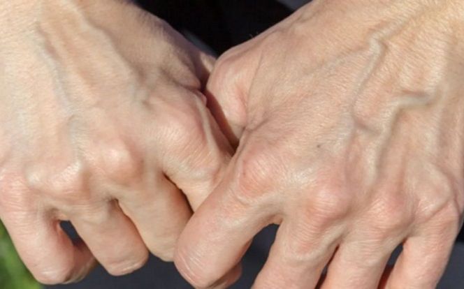 Máu có màu đỏ, tại sao các tĩnh mạch lại màu xanh?