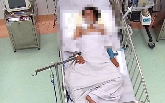 Bé trai bị rắn cạp nia cắn nguy kịch lúc nửa đêm