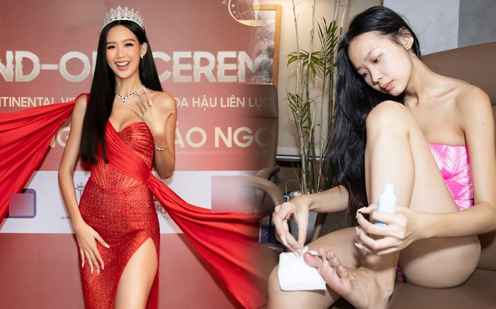 Trước thềm chinh chiến tại Miss Intercontinental, Bảo Ngọc gặp chấn thương đáng lo ngại