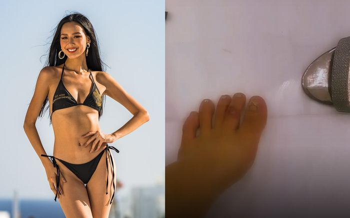 Netizen xót xa khi nhìn thấy Á hậu Bảo Ngọc 'khoe' bàn chân đầy thương tích sau phần thi áo tắm