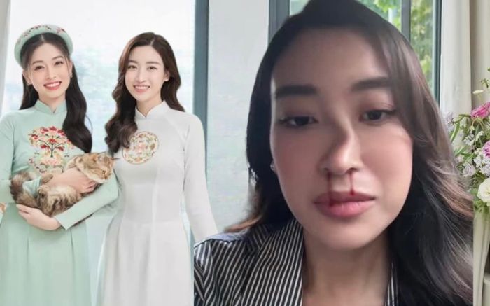 Đỗ Mỹ Linh 'đu trend' với chiếc mũi biến dạng nhưng netizen không nhịn được cười