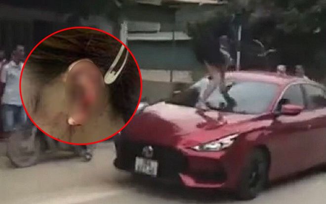 Công an vào cuộc xác minh điều tra vụ người phụ nữ đánh ghen chặn xe ô tô, cắn đứt tai tình địch