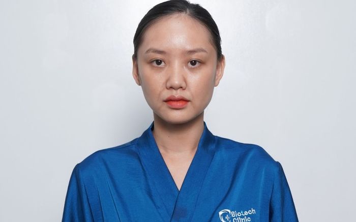 Xóa sạch nếp nhăn, gương mặt căng mịn nhờ công nghệ Mô sinh học Bio MaxFace