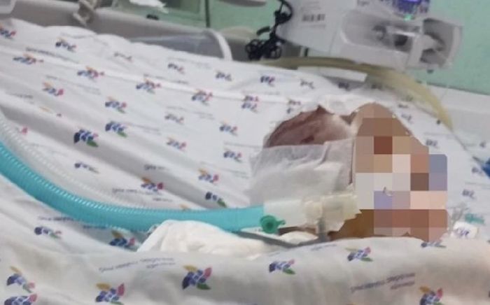 Bé trai 6 tháng tuổi bị bạo hành: Nạn nhân hôn mê sâu, tỷ lệ thương tích 99%