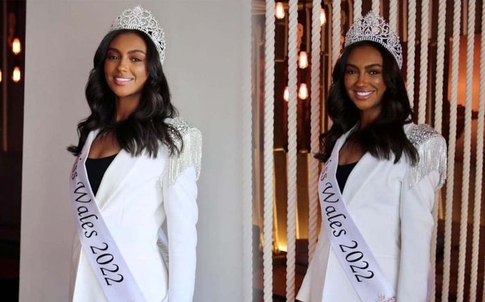 Thí sinh Miss World gặp tai nạn trước thềm tham gia thi đấu: Xót xa cho gương mặt xinh đẹp