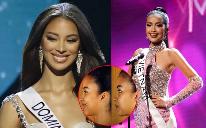 Á hậu 2 Miss Universe 2022 lộ loạt ảnh 'đập mặt xây lại', fan thảng thốt: Dù sao cũng vượt mặt Ngọc Châu