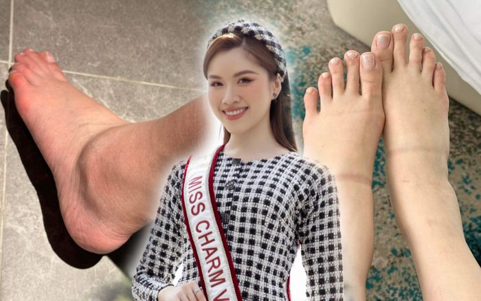 Fan xót xa cho đôi chân sưng húp của Thanh Thanh Huyền: Tất cả vì chiếc sash ở trên vai