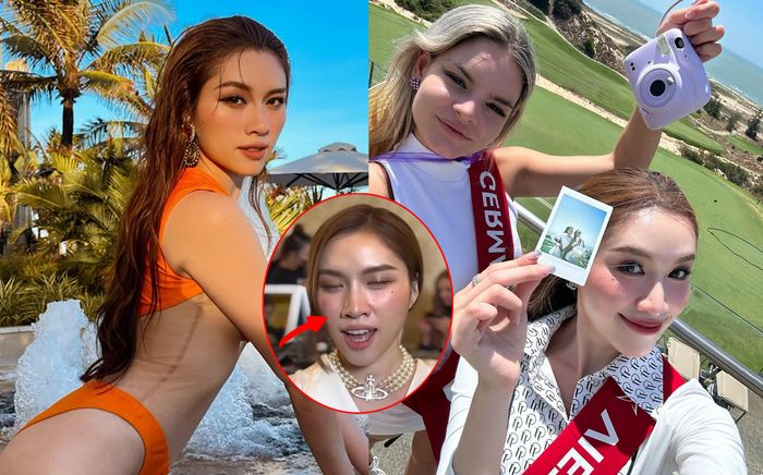 Bị chê kém sắc, Thanh Thanh Huyền lộ thêm dấu hiệu 'dao kéo lỗi' qua cam thường