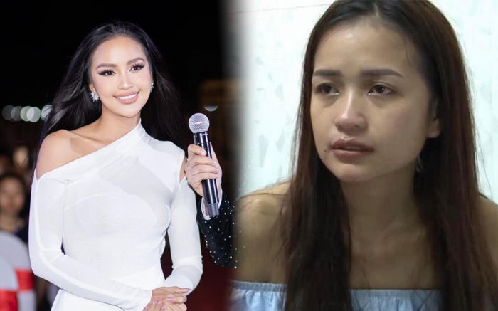 Ngọc Châu lộ ảnh 'đập đi xây lại' toàn bộ gương mặt dù đã từng phủ nhận chuyện dao kéo