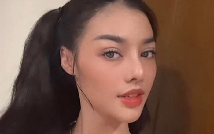 Á hậu Kiều Loan để lộ sống mũi gồ ghề hậu vướng vào nghi vấn can thiệp 'dao kéo'