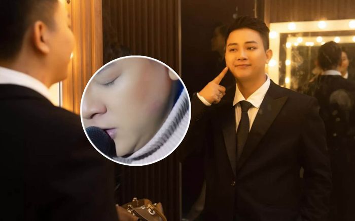 Hoài Lâm bị khán giả nữ hôn đỏ má, lên tiếng 'truy tìm' chủ nhân dấu son môi