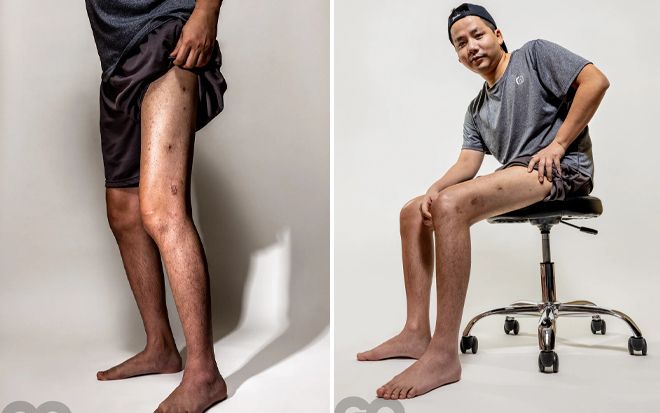 Khoa Pug xuất hiện trên báo Mỹ, lần đầu khoe cận đôi chân dài 5 tỷ