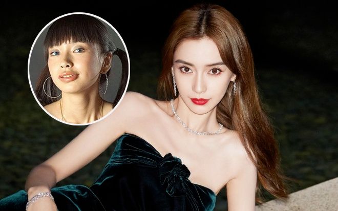 Cái giá phải trả khi gọi Angelababy là 'cô gái răng vẩu'