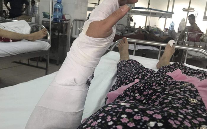 Chồng tung 'liên hoàn cước' khiến vợ bất tỉnh rồi thản nhiên bấm điện thoại