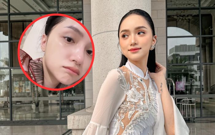 Hương Giang để lộ diện mạo hốc hác, thông báo tình trạng sức khoẻ không ổn định