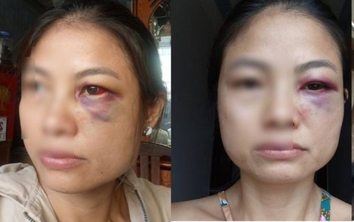 Người mẹ và con gái 16 tuổi ở Đồng Nai đến cầu cứu công an vì lý do bất ngờ