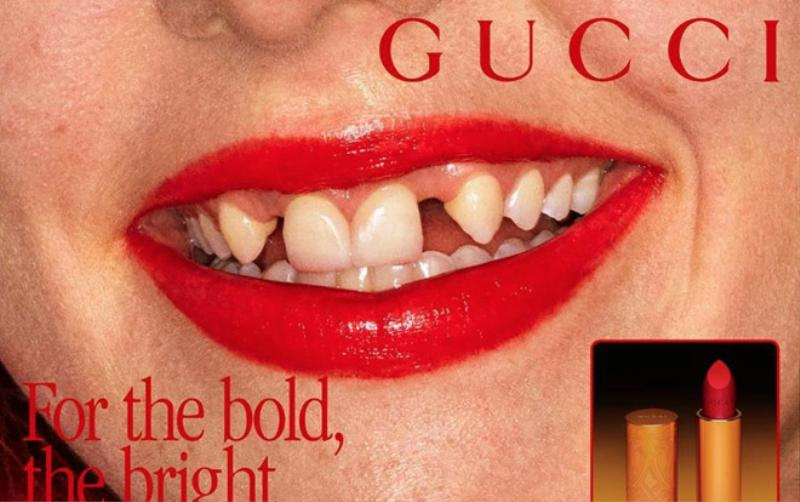 Gucci sử dụng người mẫu răng vàng ố, sún hở lợi để quảng cáo son môi