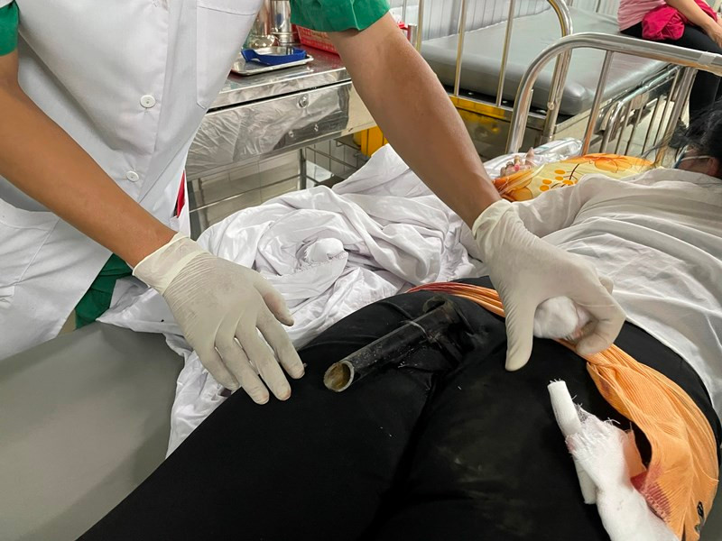Cấp cứu thành công cô gái bị chân chống xe máy đâm vào mông sau va chạm giao thông Ảnh 1