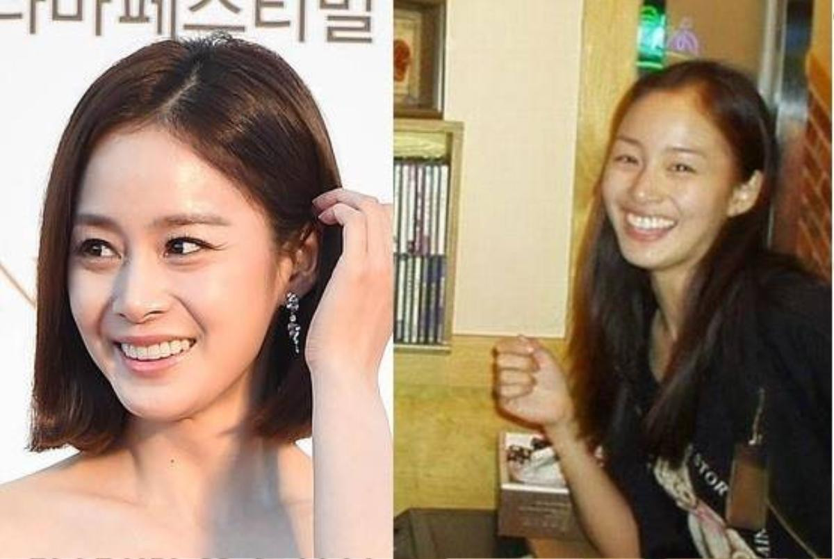 Kim Tae Hee cũng mât điểm vì răng to và hơi vẩu khiến hàm răng dường như choáng ngợp gương mặt mỗi khi cười. Hiện tại, diện mạo của bạn gái Bi Rain được nhận xét hoàn hảo. 