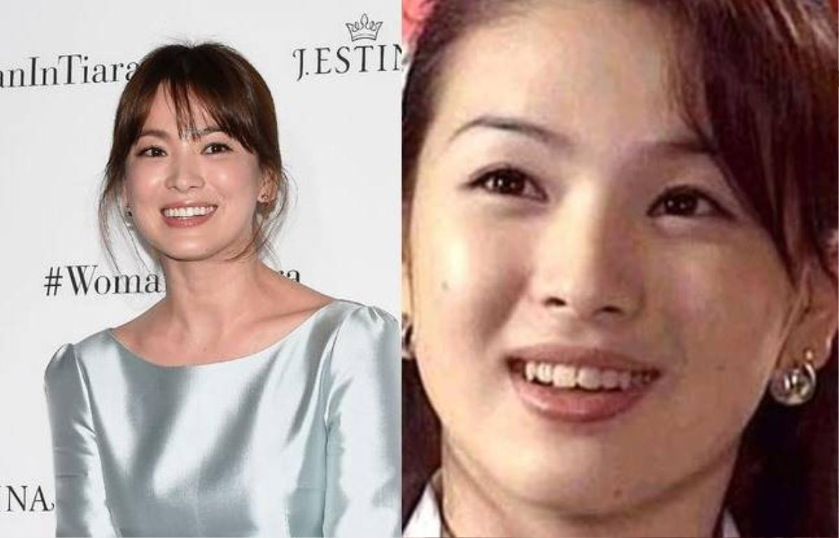 Thời chưa nổi tiếng, hàm răng của Song Hye Kyo không đồng đều khiến nụ cười kém đẹp. Sau khi sửa răng, người đẹp mặt mộc tự tin hơn.