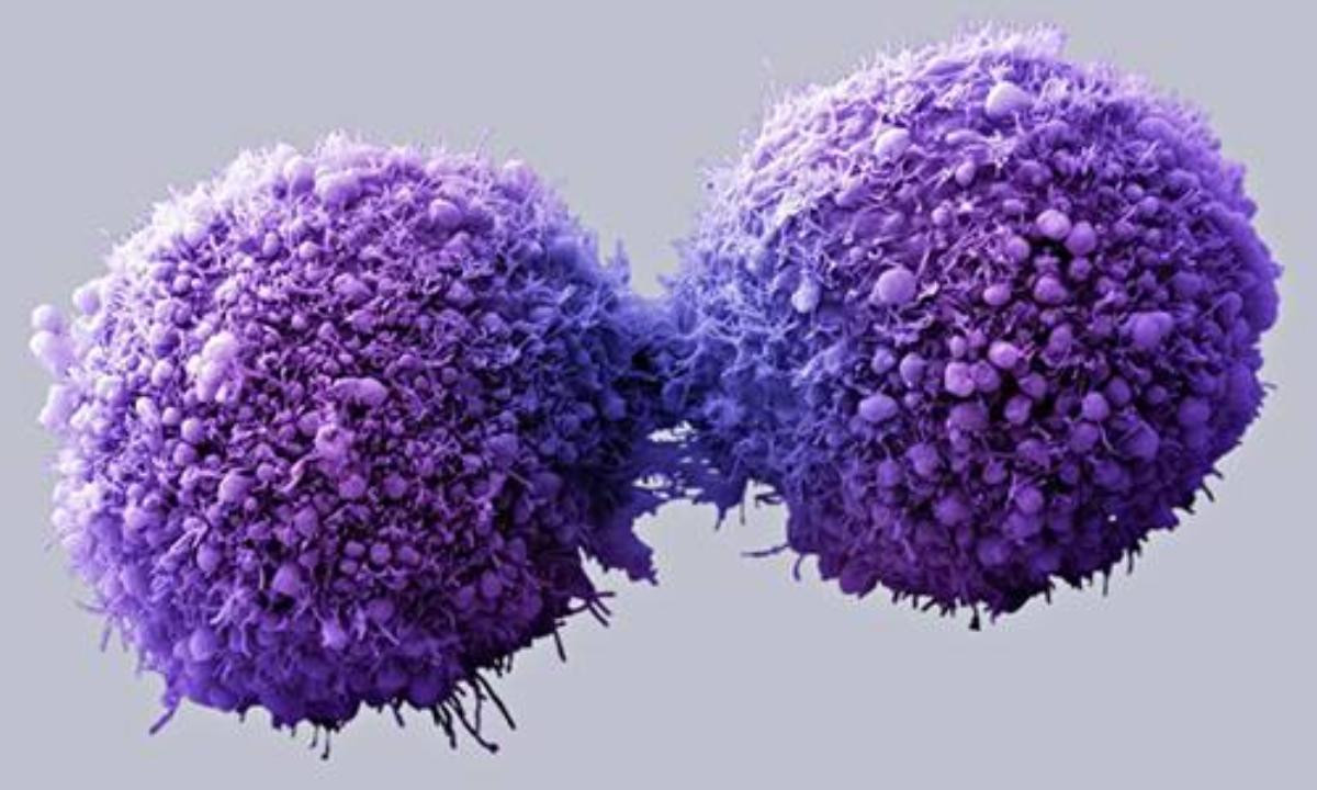 Pancreatic cancer cells