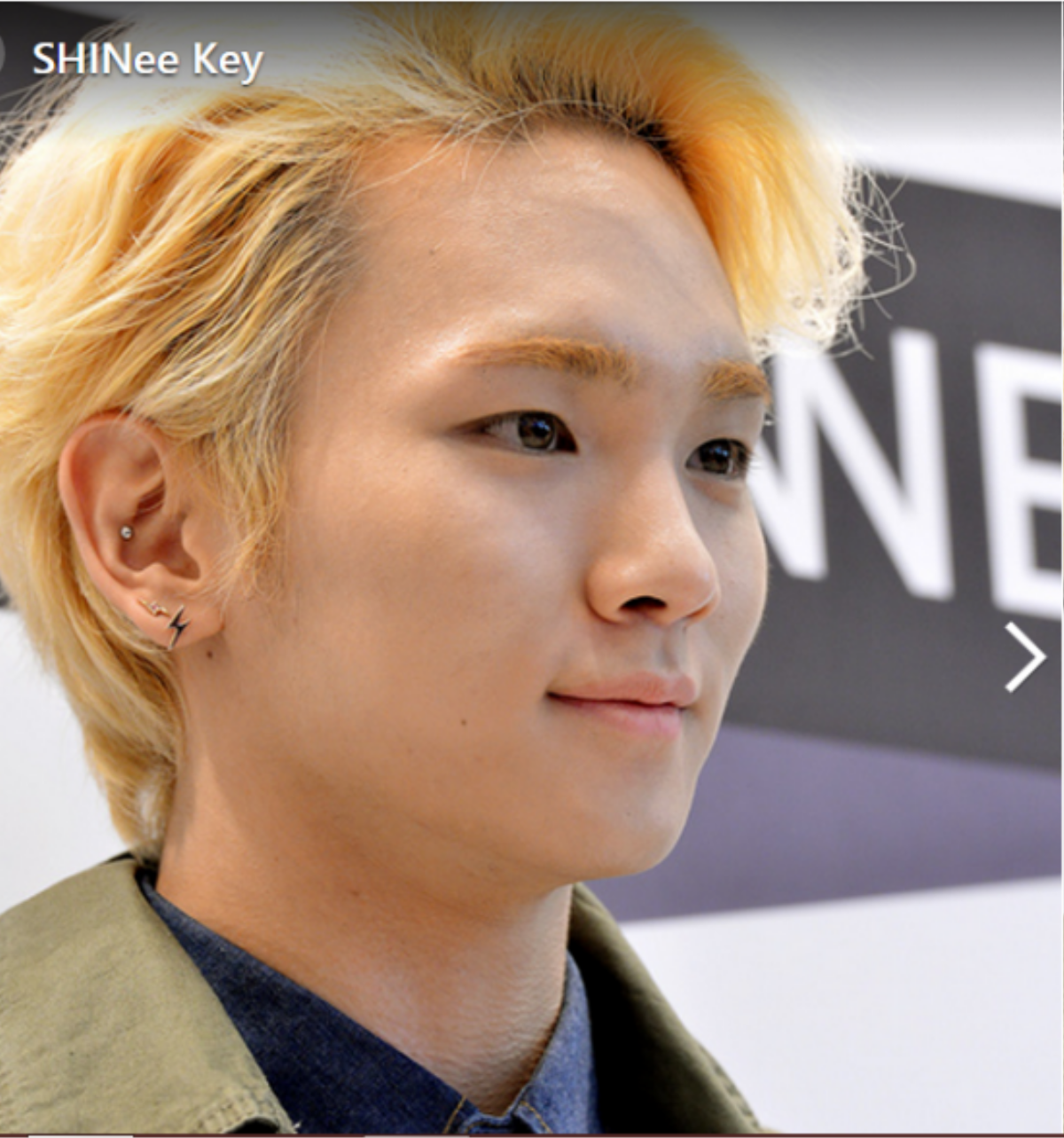 Key (SHINee) với mái tóc “một mất một còn” lộ rõ vùng chân tóc bị thụt sâu.