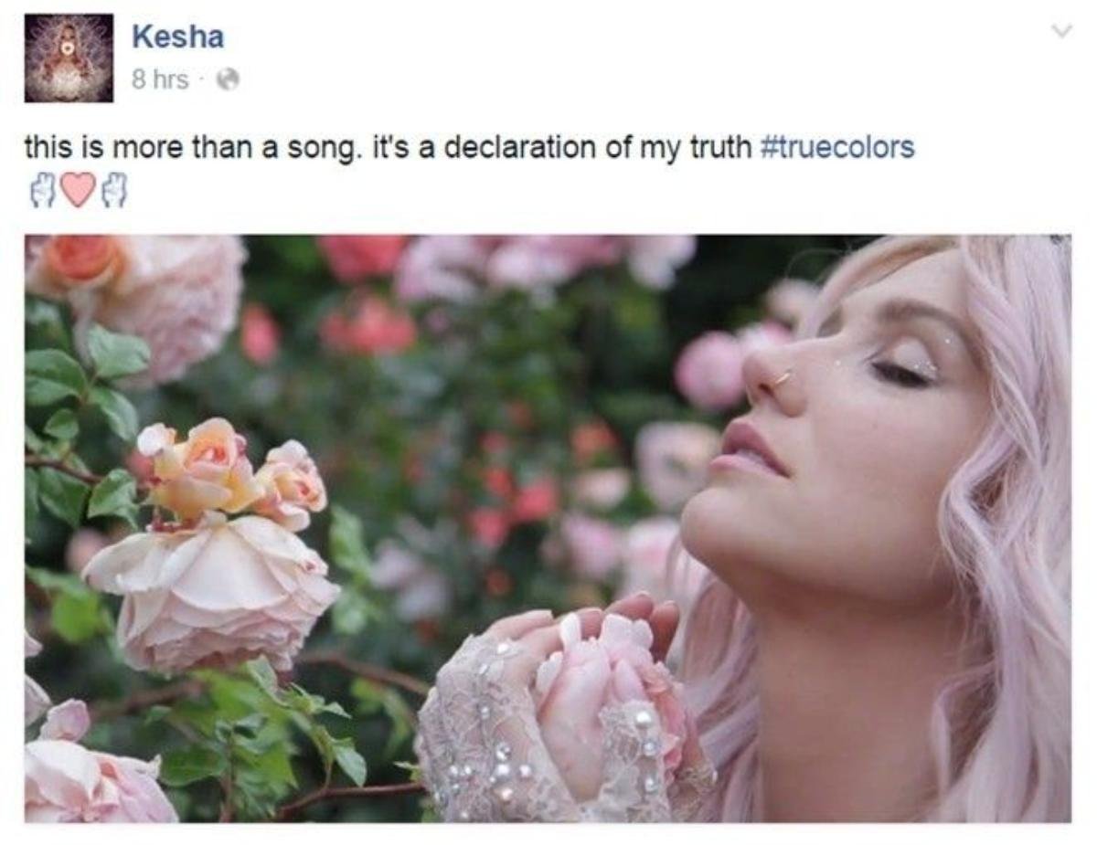 kesha