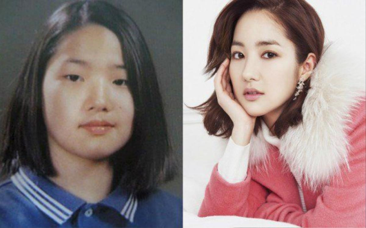 Trước khi sở hữu vẻ đẹp rạng ngời như hiện tại, Park Min Young từng là một cô bé bầu bĩnh và mập mạp với những đường nét không có gì nổi bật. Phẫu thuật thẩm mỹ thực sự đã trở thành vị cứu tinh của cô gái sinh năm 1986 này khi không chỉ giúp cô có bề ngoài hoàn hảo mà còn đưa cô tới những cơ hội trong lĩnh vực điện ảnh và người mẫu. Không ngoa khi nói cô là siêu phẩm của ngành thẩm mỹ.