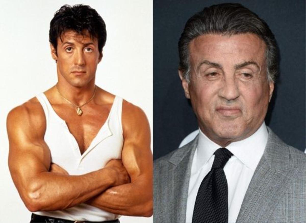 Giống như Mickey Rourke, Sylvester Stallone nằm trong số ít những nam nghệ sĩ không ngần ngại thừa nhận từng phẫu thuật thẩm mỹ.