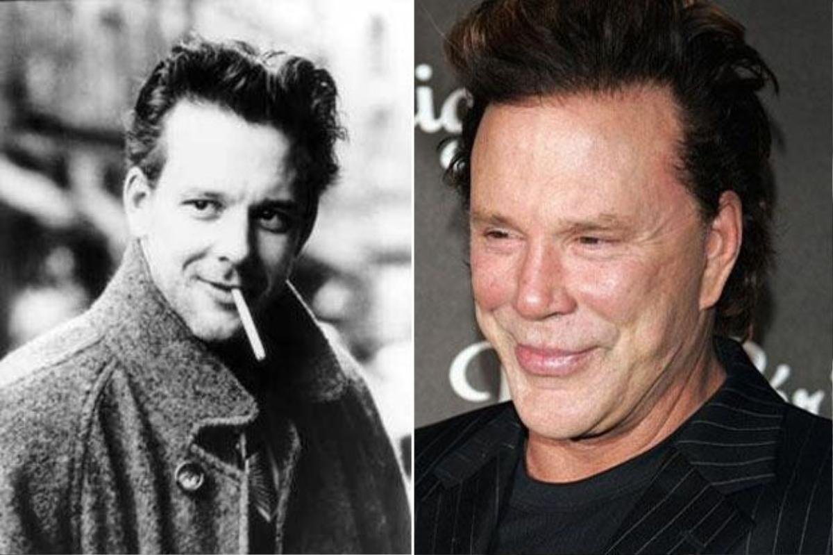 Mickey Rourke thừa nhận ông rất nhiều lần nhờ đến dao kéo với những cuộc trùng tu khuôn mặt từ mắt đến mũi, má.