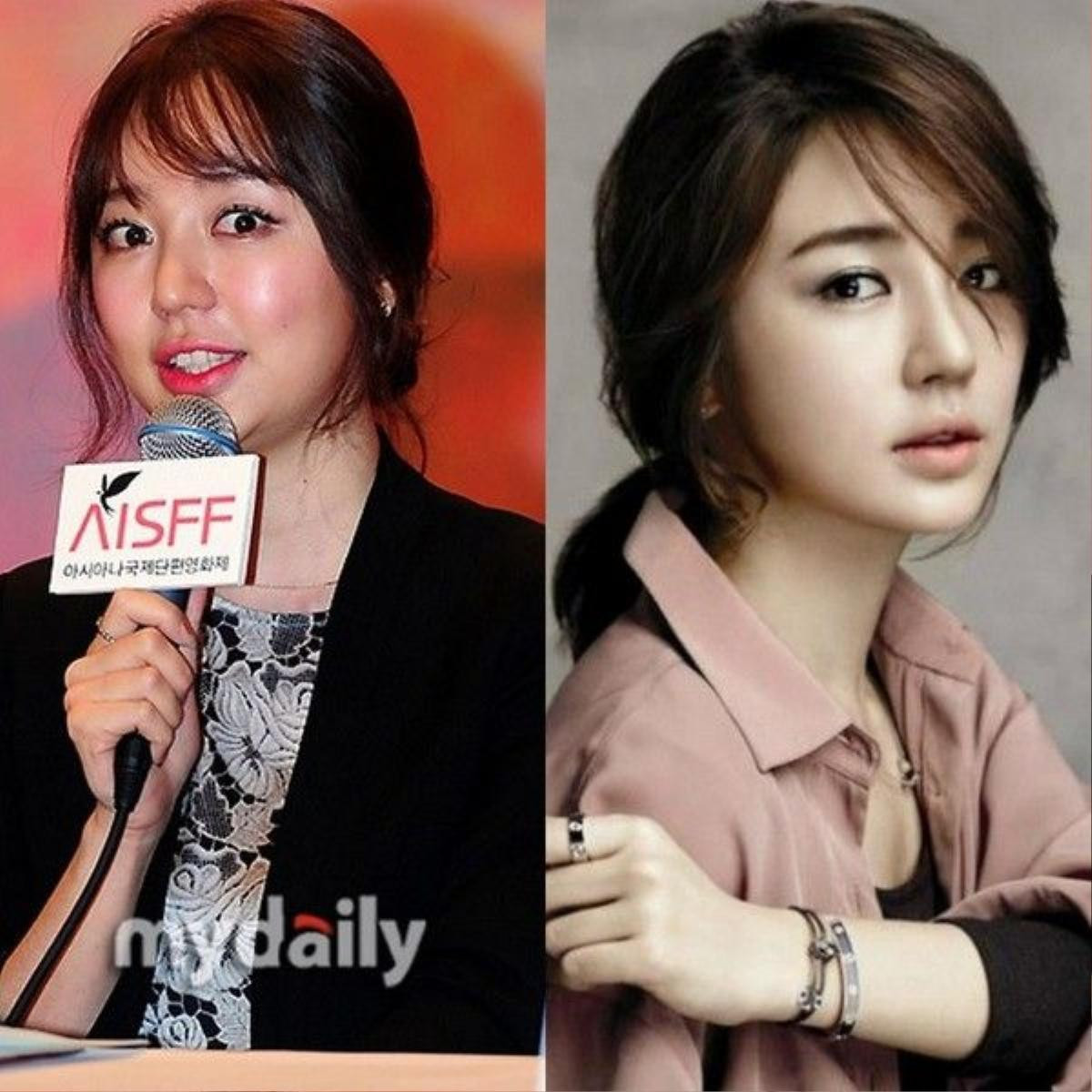 Park Shin Hye từng khiến fans giật mình bởi khuôn mặt căng bóng và cứng đờ do tiêm botox quá đà.