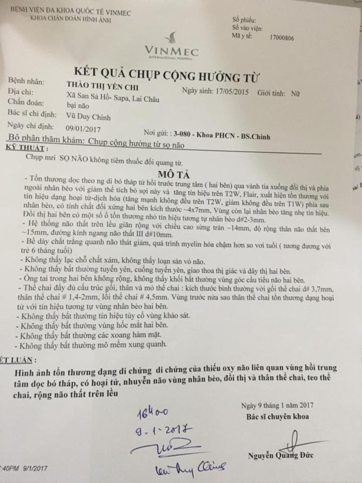 Mẹ nuôi của em bé Lào Cai suy dinh dưỡng lên mạng cầu cứu giúp đỡ vì phát hiện bé tổn thương não Ảnh 4