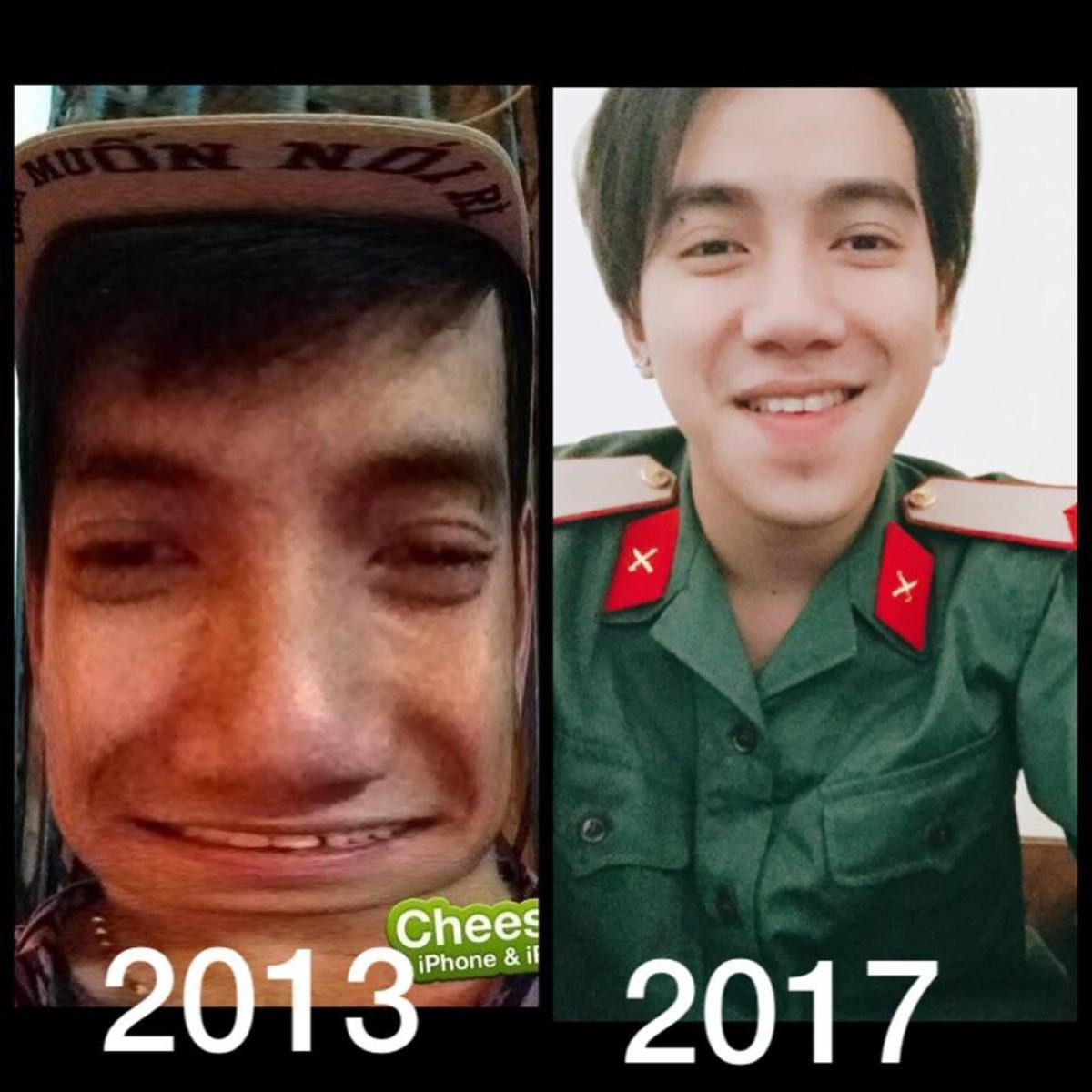 #PubertyChallenge - thí sinh The Voice tự tin khoe ảnh thời 'chưa lột xác' Ảnh 14