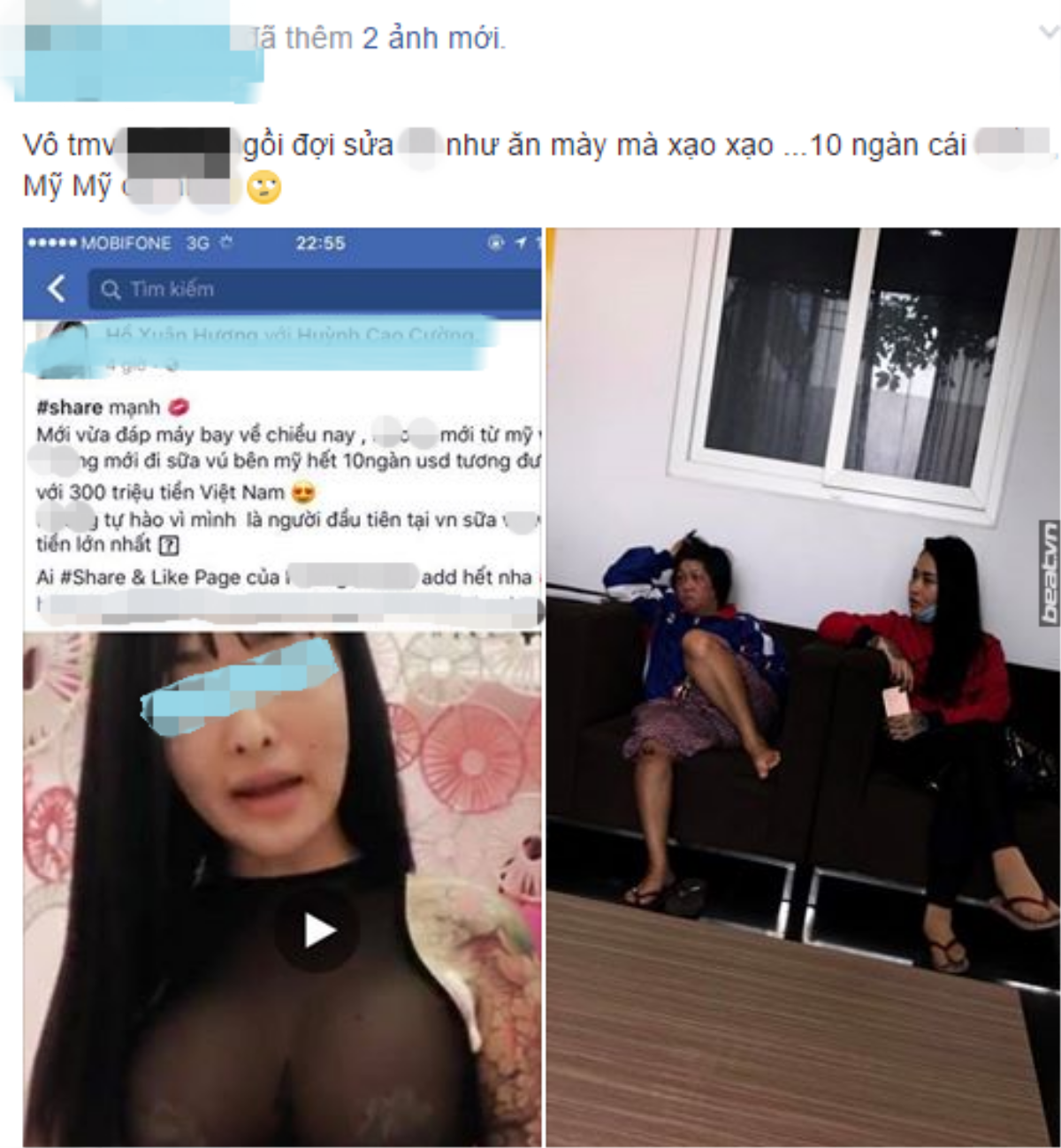 Khoe nâng ngực 300 triệu tại Mỹ, 'hot girl' ăn chặn tiền từ thiện bị bóc mẽ nhếch nhác tại thẩm mỹ viện Việt Ảnh 2