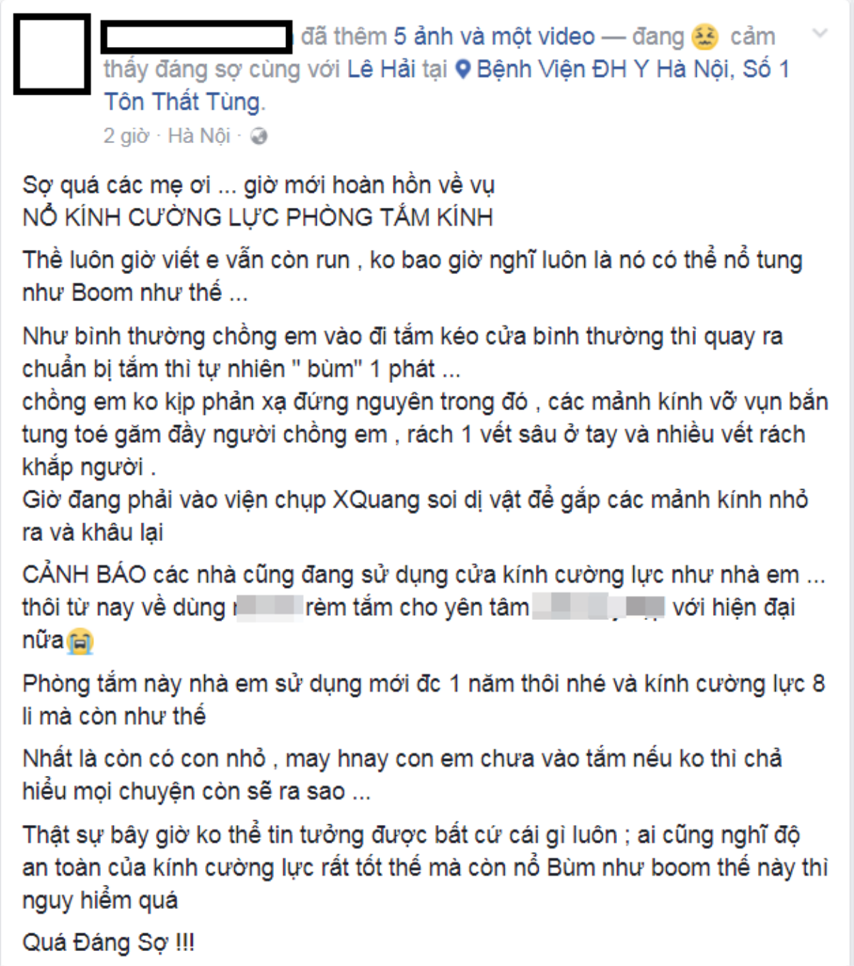 Phải vào bệnh viện vì kính cường lực trong phòng tắm đột nhiên phát 'nổ như bom’ Ảnh 1