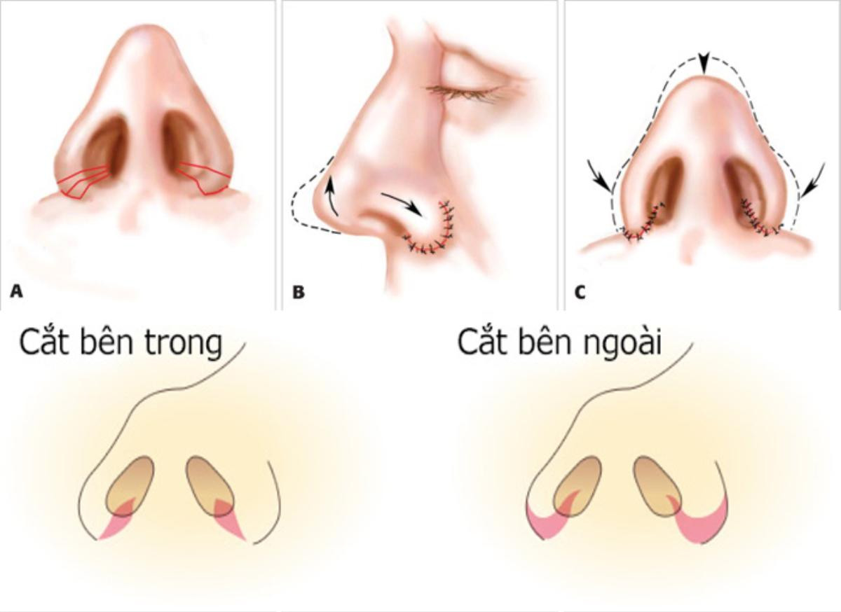 Tất tần tật những bước phẫu thuật Đức Phúc phải trải qua để sở hữu gương mặt mới Ảnh 10