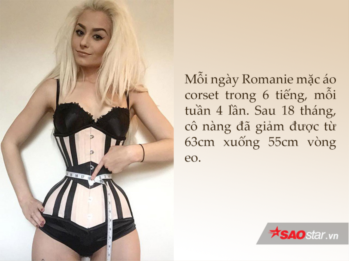 Giảm cân bằng áo corset: Cái giá phải trả để có thân hình đồng hồ cát? Ảnh 3