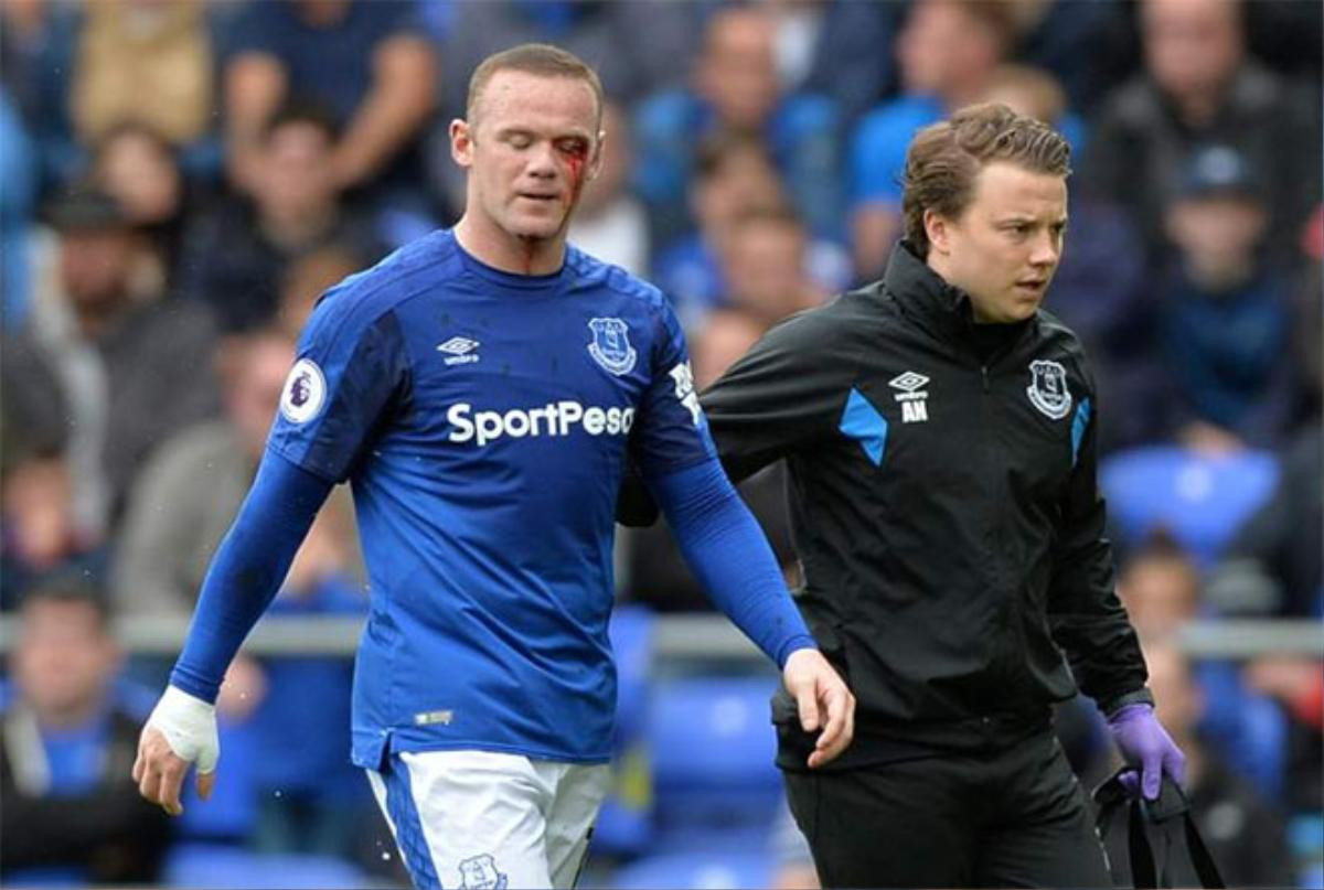 Máu trên mắt Rooney và 'chiêu độc' của Mourinho Ảnh 3