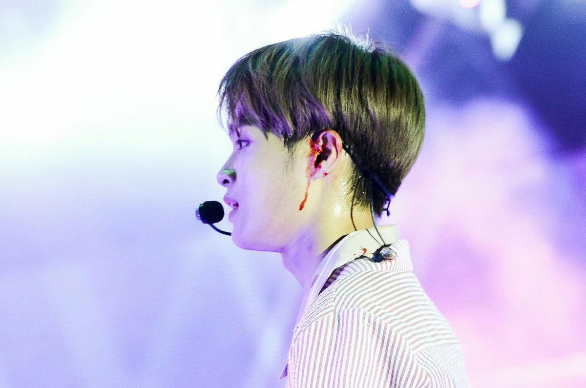 Thành viên Wanna One chấn thương, netizen phẫn nộ khi quản lí bắt ở lại chụp ảnh Ảnh 2