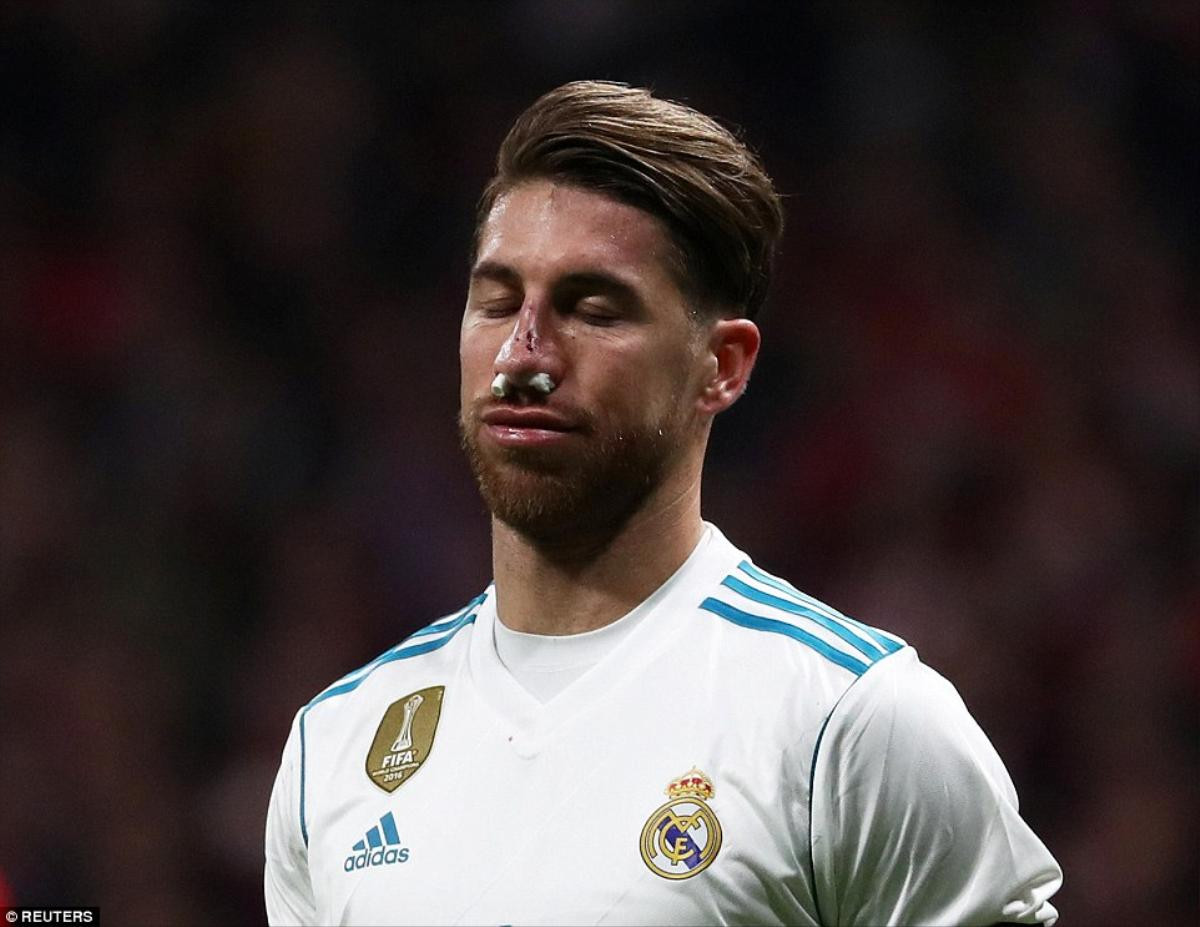 Cận cảnh pha vỡ mũi kinh hoàng của Ramos khiến Real ‘giương cờ trắng’ trước Barca Ảnh 4