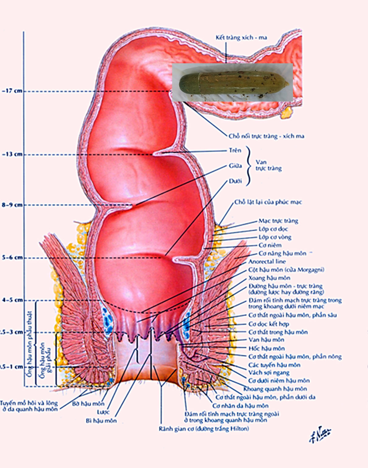 Một bác sĩ phải cấp cứu vì lọt cả quả dưa leo vào bụng Ảnh 1