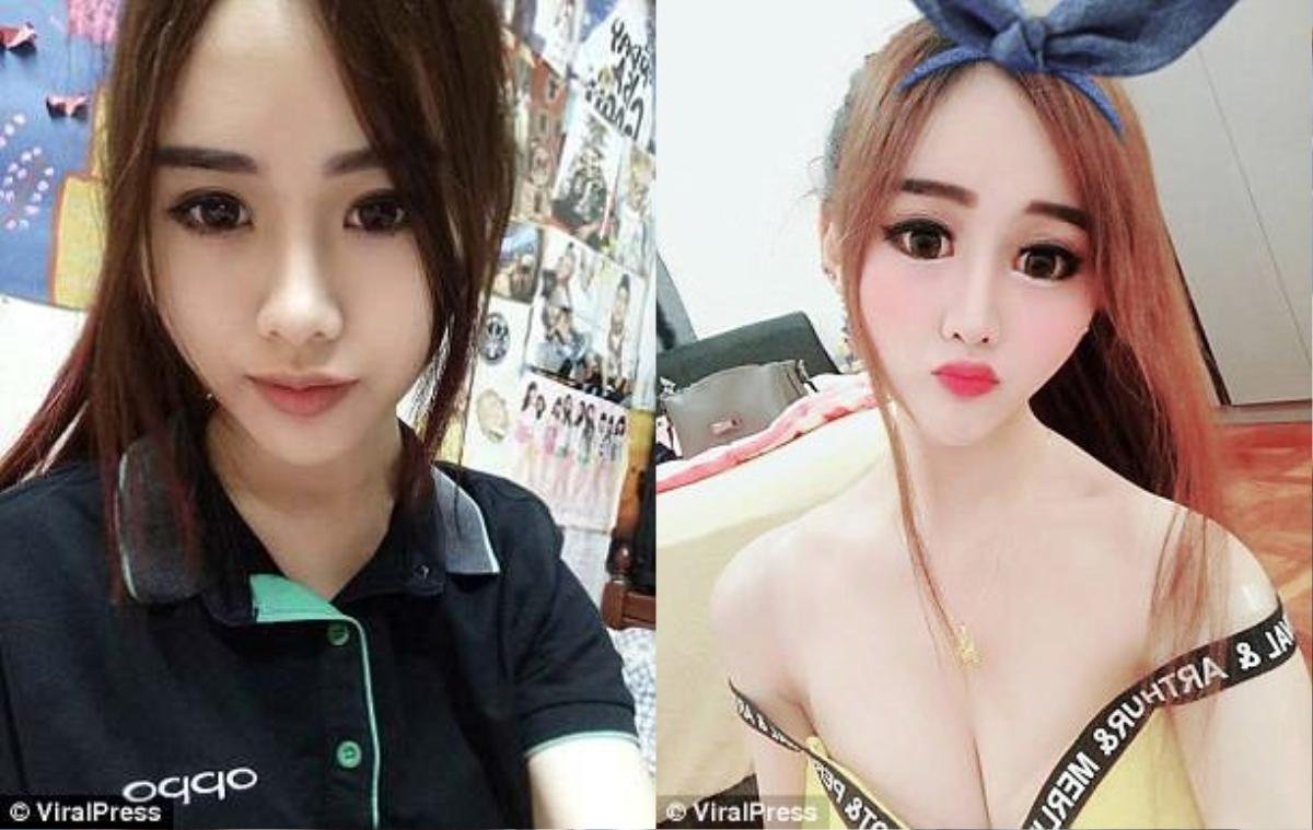 Đang xinh đẹp, 'hot girl' phẫu thuật thẩm mỹ khiến gương mặt như người ngoài hành tinh Ảnh 1